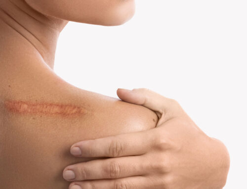 Plastisch-Rekonstruktive Chirurgie